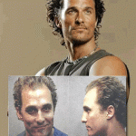 matthew-mcconaughey-hair-loss-photo-how-did-matthew-mcconaughey-grow-hair-back-hairloss-blog-zenagen-shampoo