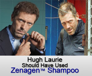 Hugh Laurie (House MD) Hair Loss