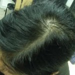 female-thinning-hair-hair-loss-celeb-hair-loss-2